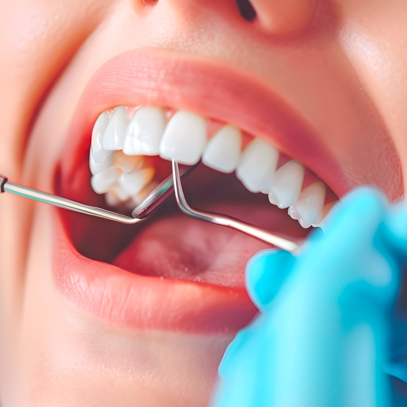 Teaser-gesunde-zaehne